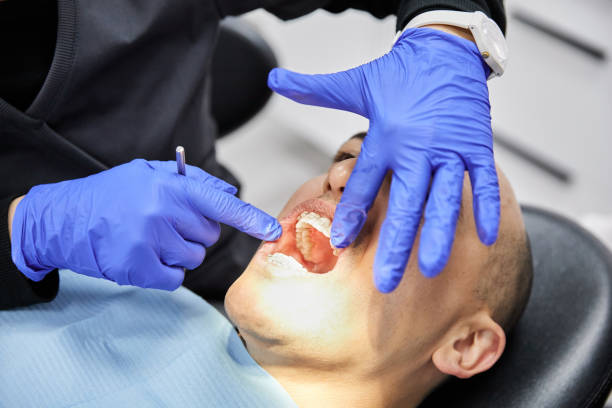 Best Emergency Dentist for Knocked-Out Tooth in Golden Meadow, LA